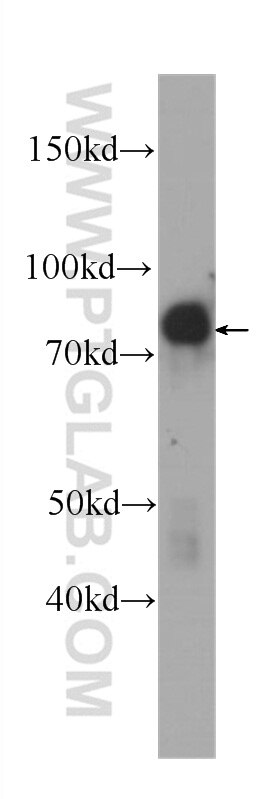 Western Blot (WB) analysis of MCF-7 cells using Zyxin Monoclonal antibody (60254-1-Ig)