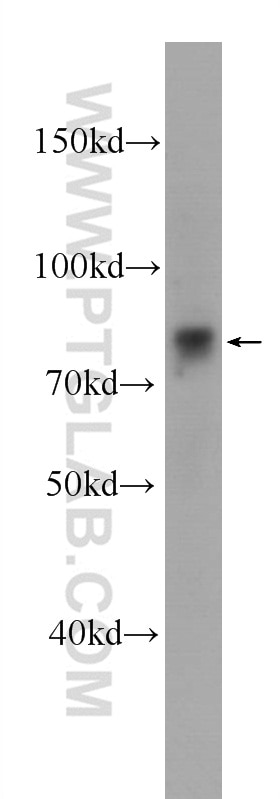 Western Blot (WB) analysis of A431 cells using Zyxin Monoclonal antibody (60254-1-Ig)