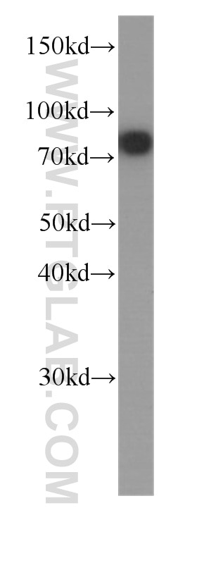 Western Blot (WB) analysis of HeLa cells using Zyxin Monoclonal antibody (60254-1-Ig)