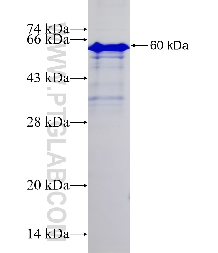 ZYX fusion protein Ag0419 SDS-PAGE