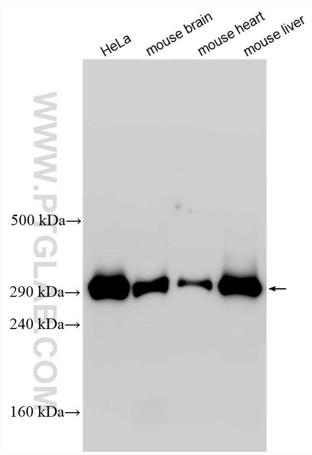 Western Blot (WB) analysis of various lysates using ZZEF1 Polyclonal antibody (33605-1-AP)
