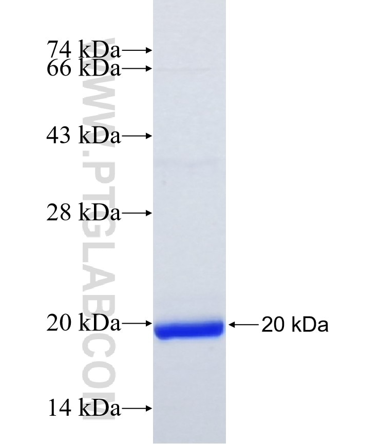 ZZEF1 fusion protein Ag35499 SDS-PAGE ZZEF1 fusion protein Ag35499 SDS-PAGE