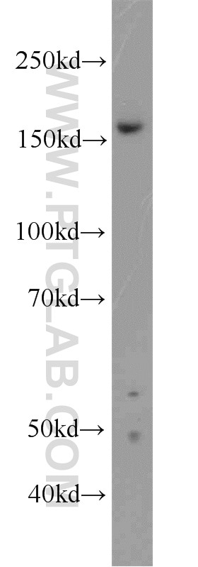 Western Blot (WB) analysis of HEK-293 cells using ZZZ3 Polyclonal antibody (22608-1-AP)