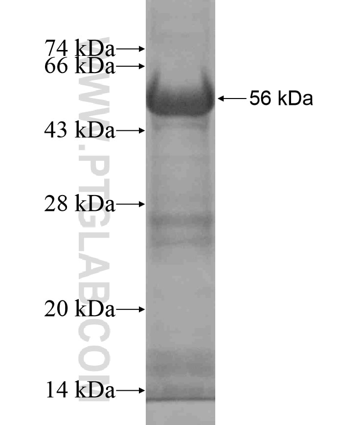 ZZZ3 fusion protein Ag18362 SDS-PAGE