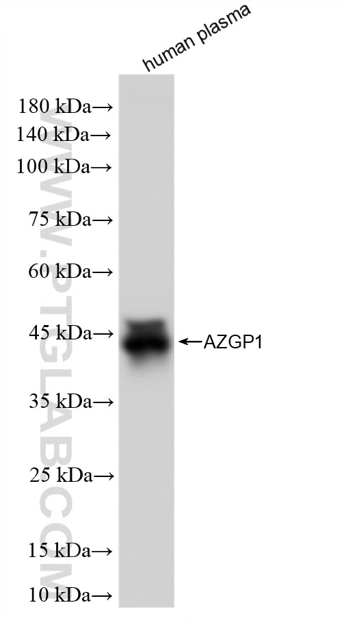 Western Blot (WB) analysis of human plasma using Zinc Alpha 2 Glycoprotein Recombinant monoclonal a (86781-3-RR)