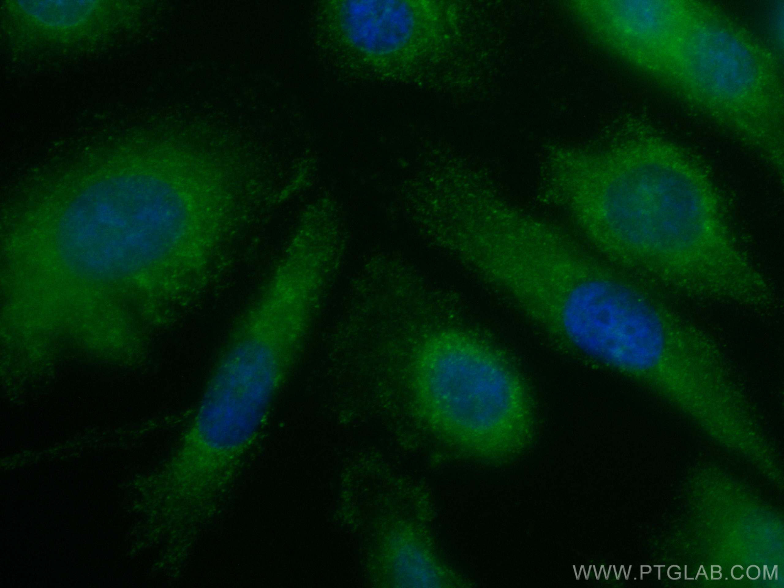 Immunofluorescence (IF) / fluorescent staining of PC-3 cells using CoraLite® Plus 488-conjugated Zinc Alpha 2 Glycopr (CL488-66178)