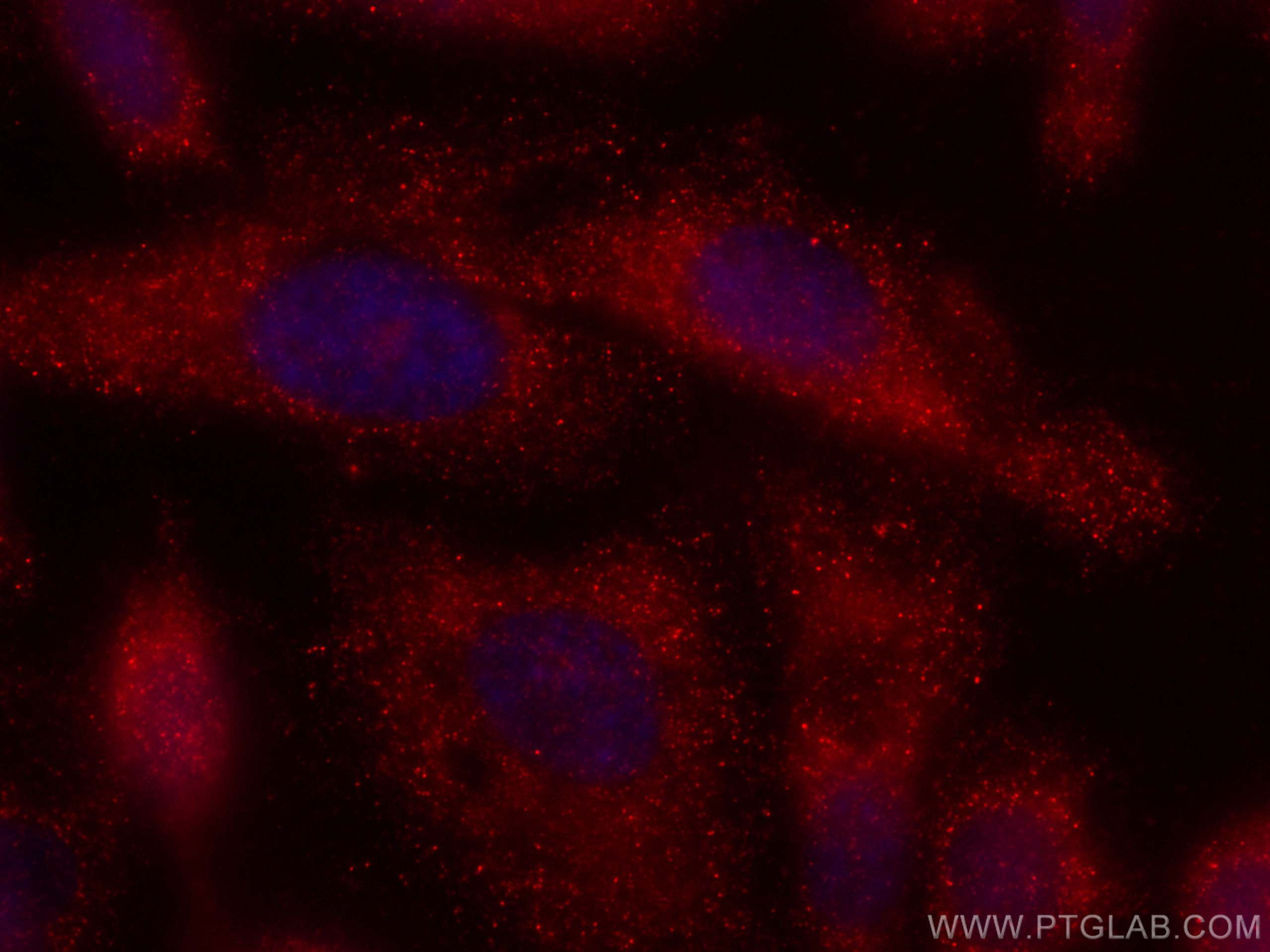 Immunofluorescence (IF) / fluorescent staining of PC-3 cells using CoraLite®594-conjugated Zinc Alpha 2 Glycoprotein  (CL594-66178)