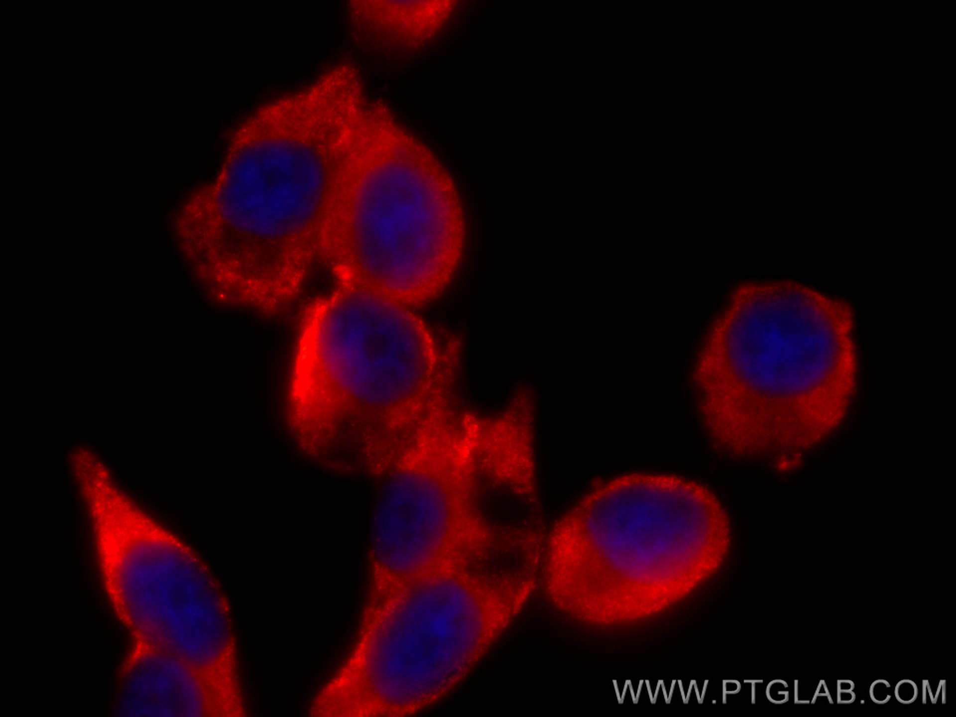 Immunofluorescence (IF) / fluorescent staining of PC-3 cells using CoraLite®594-conjugated Zinc Alpha 2 Glycoprotein  (CL594-66178)
