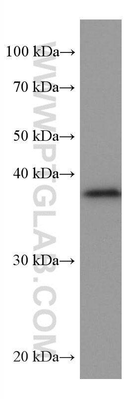 Western Blot (WB) analysis of human testis tissue using ZnT3 Monoclonal antibody (67262-1-Ig)