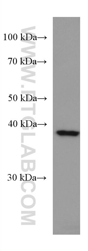 WB analysis of HEK-293 using 67262-1-Ig