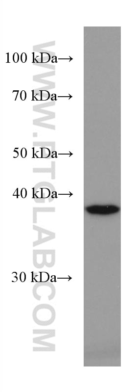 Western Blot (WB) analysis of Jurkat cells using ZnT3 Monoclonal antibody (67262-1-Ig)