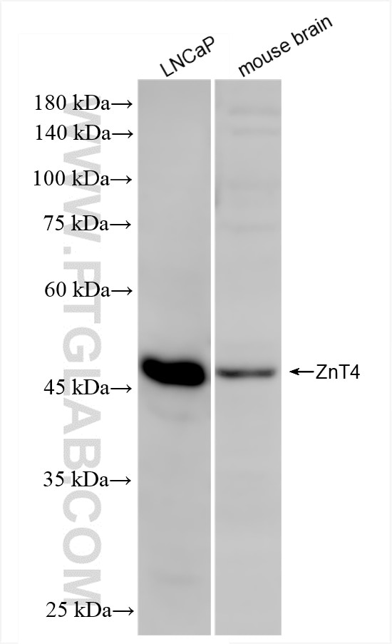 Western Blot (WB) analysis of various lysates using ZnT4 Recombinant antibody (86336-1-RR)