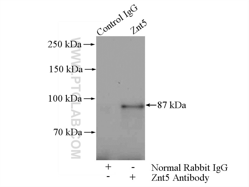 Immunoprecipitation (IP) experiment of mouse liver tissue using Znt5 Polyclonal antibody (25604-1-AP)