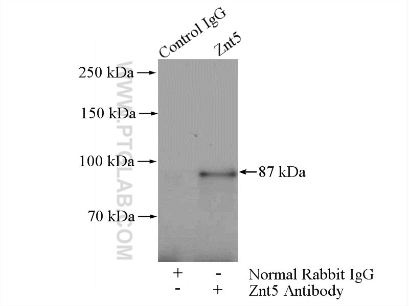 IP experiment of mouse liver using 25604-1-AP