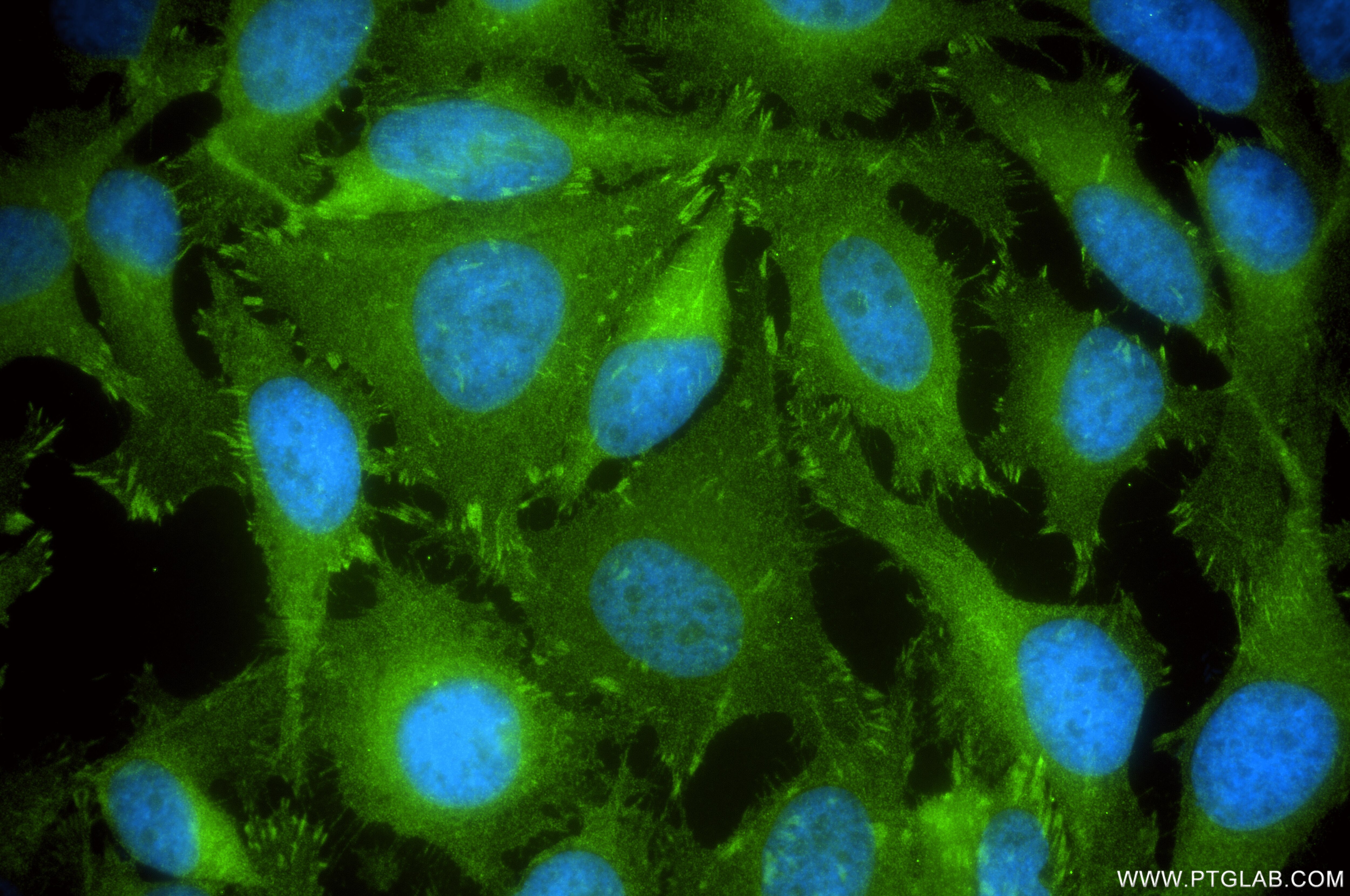 Immunofluorescence (IF) / fluorescent staining of A549 cells using Zyxin Recombinant monoclonal antibody (86364-3-RR)