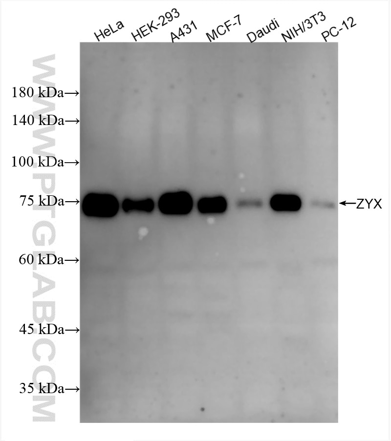 Western Blot (WB) analysis of various lysates using Zyxin Recombinant antibody (86364-3-RR)