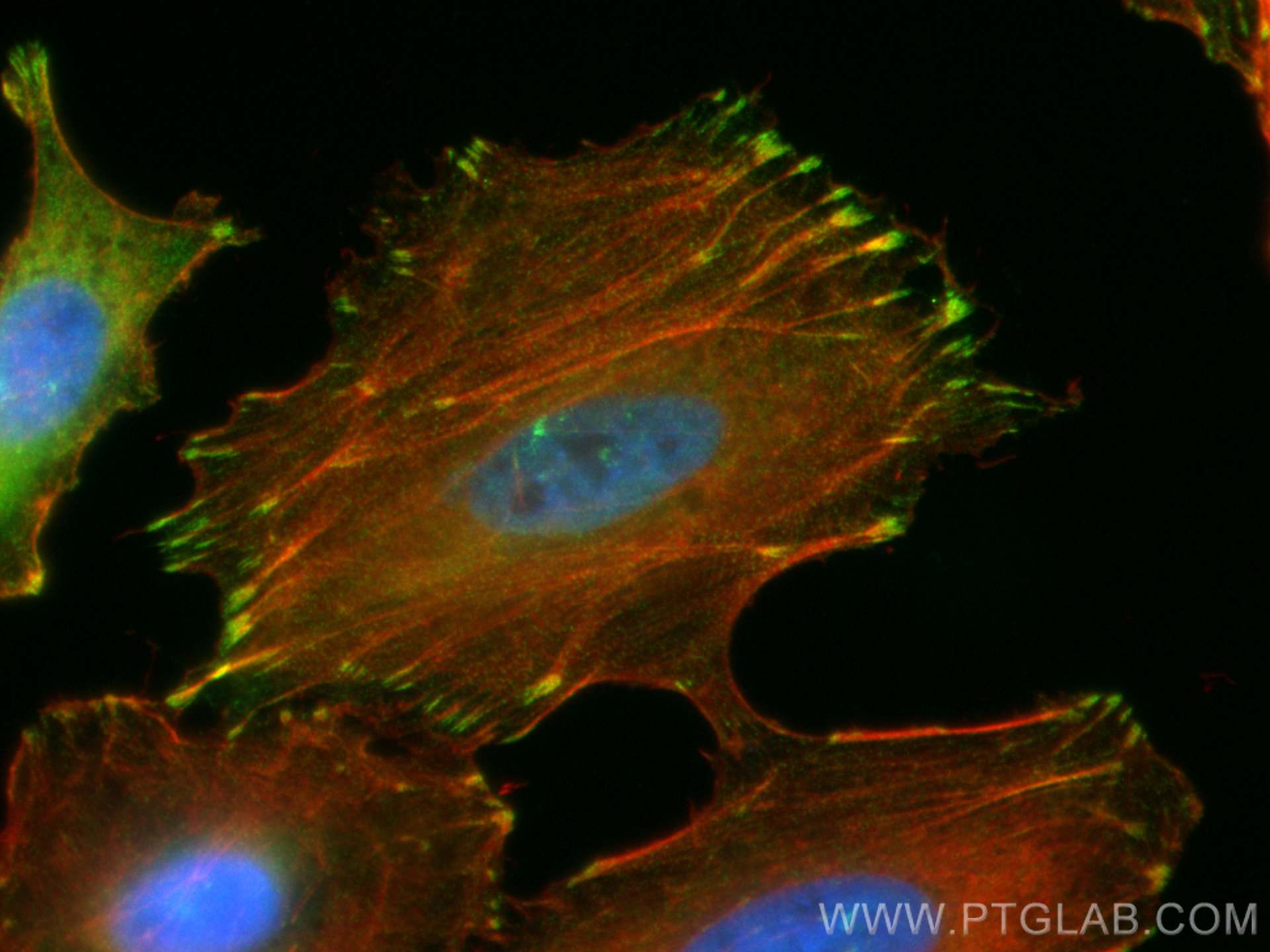 Immunofluorescence (IF) / fluorescent staining of A549 cells using CoraLite® Plus 488-conjugated Zyxin Polyclonal ant (CL488-10330)
