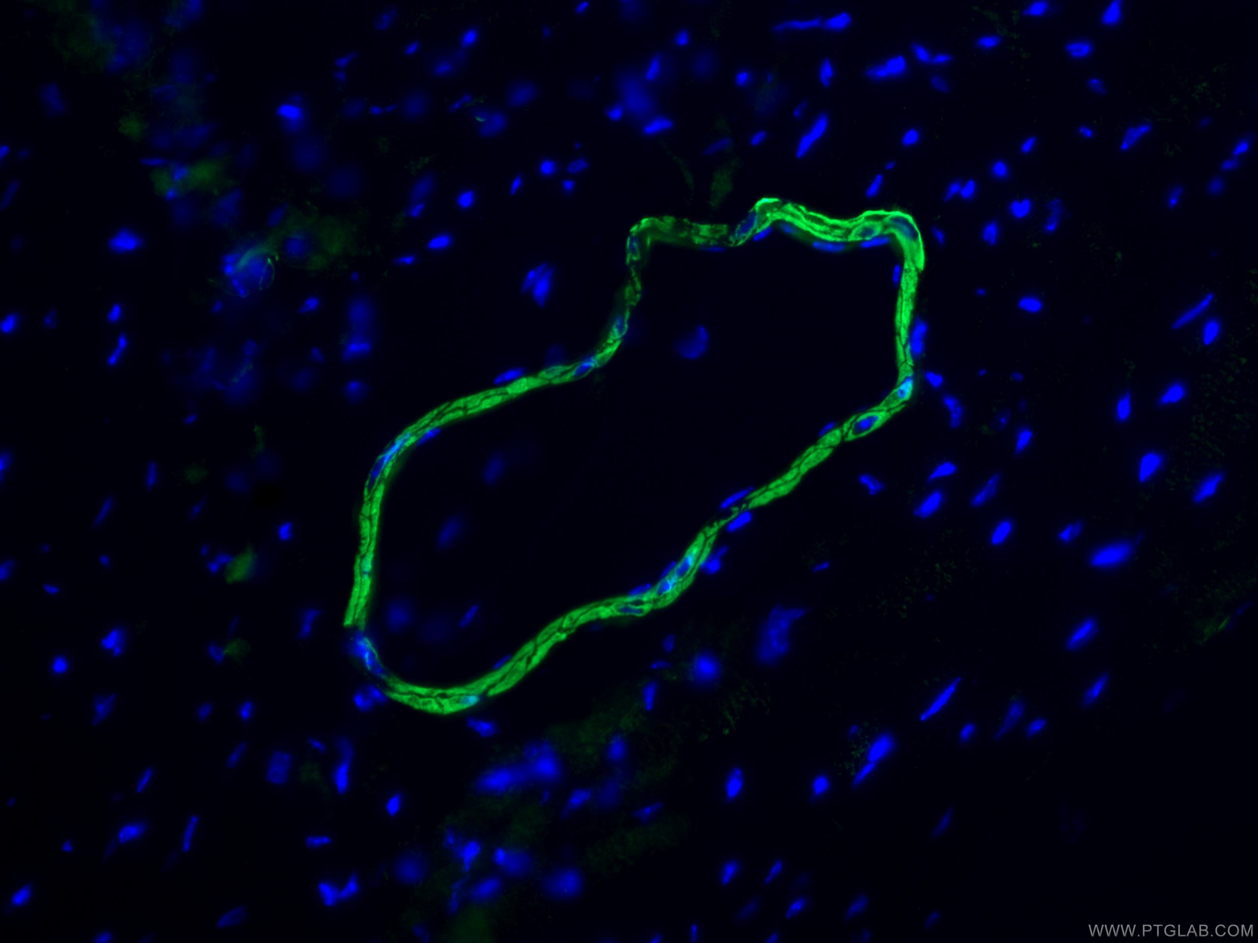 Immunofluorescence (IF) / fluorescent staining of mouse heart tissue using smooth muscle actin specific Recombinant antibody (80008-1-RR)