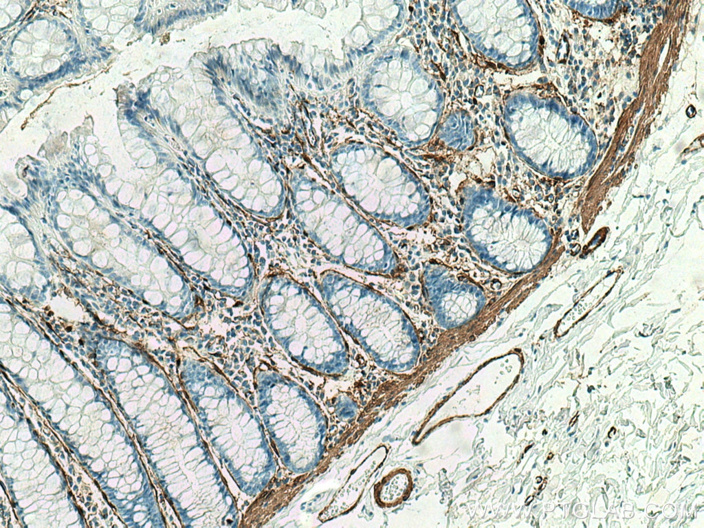 Immunohistochemistry (IHC) staining of human colon tissue using smooth muscle actin specific Recombinant antibody (80008-1-RR)