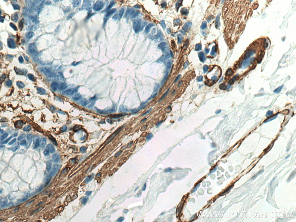 Immunohistochemistry (IHC) staining of human colon tissue using smooth muscle actin specific Recombinant antibody (80008-1-RR)