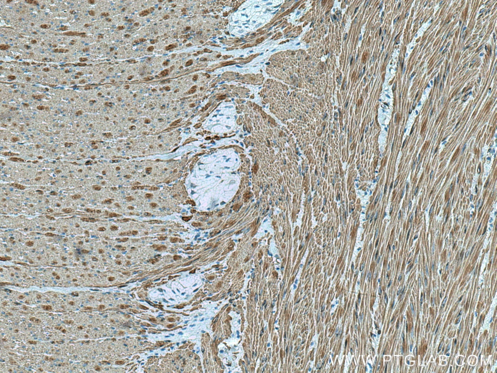 Immunohistochemistry (IHC) staining of human colon tissue using smooth muscle actin specific Recombinant antibody (80008-1-RR)