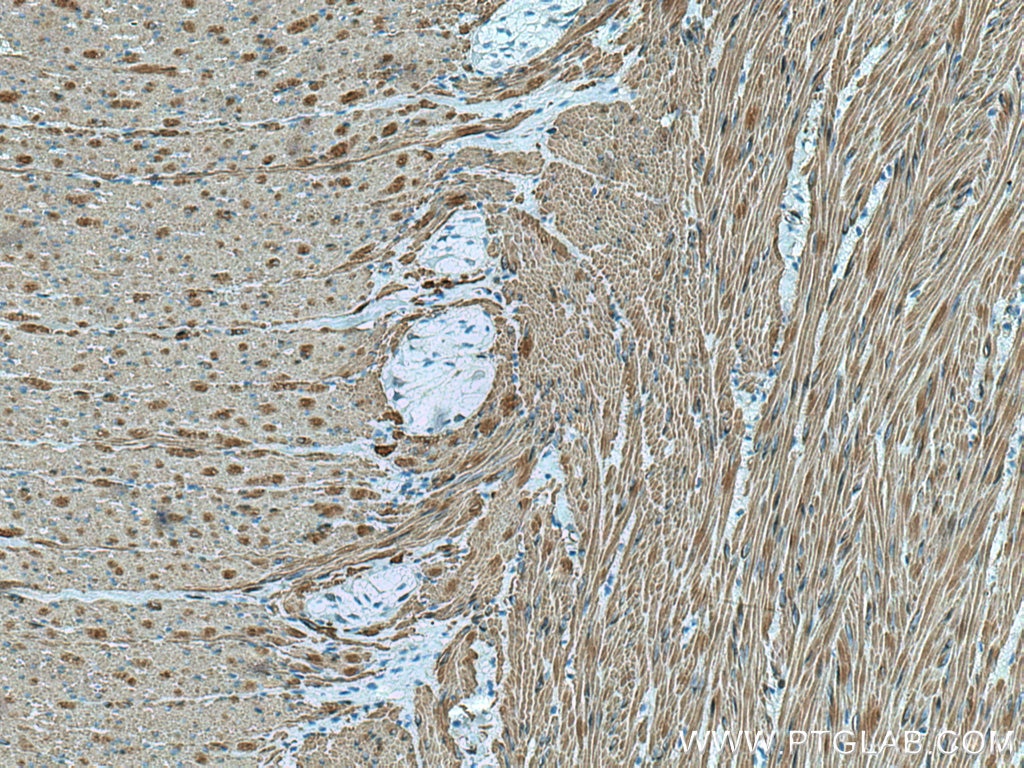 IHC staining of human colon using 80008-1-RR