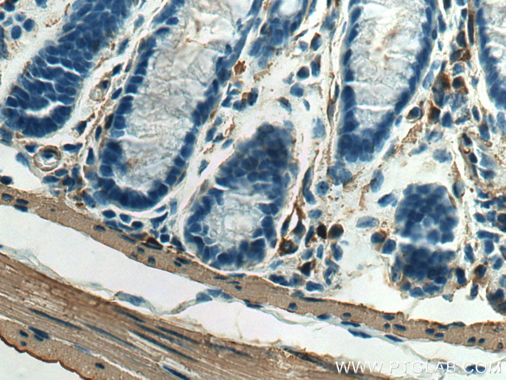 Immunohistochemistry (IHC) staining of mouse colon tissue using smooth muscle actin specific Recombinant antibody (80008-1-RR)