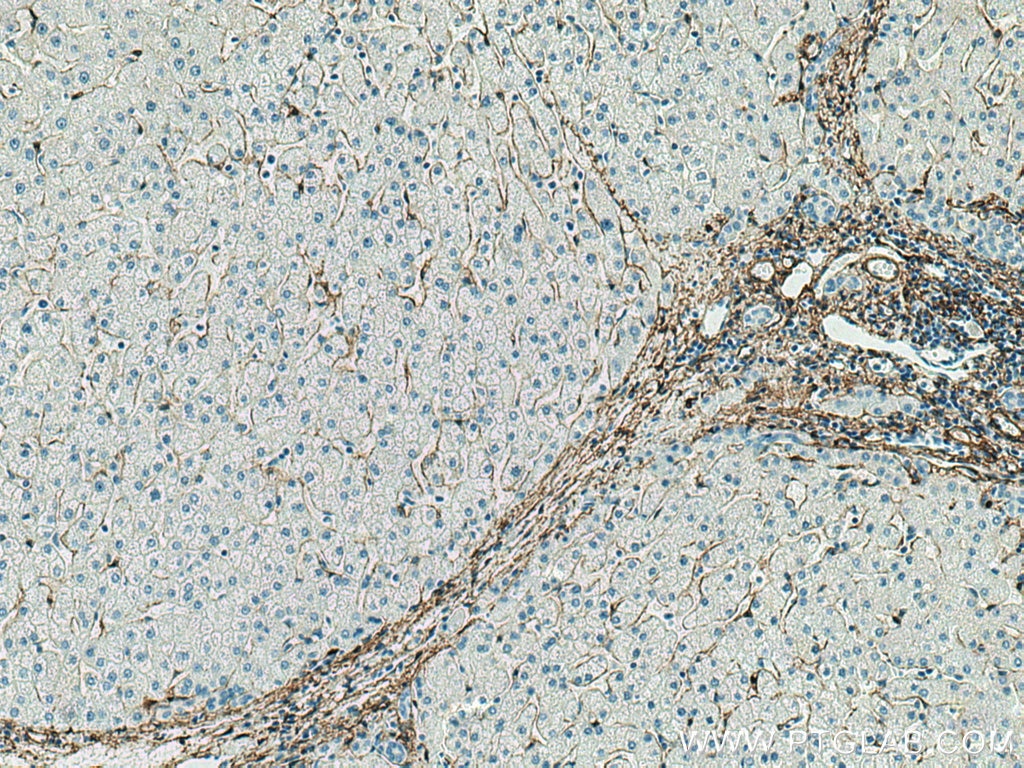 Immunohistochemistry (IHC) staining of human liver tissue using smooth muscle actin specific Recombinant antibody (80008-1-RR)