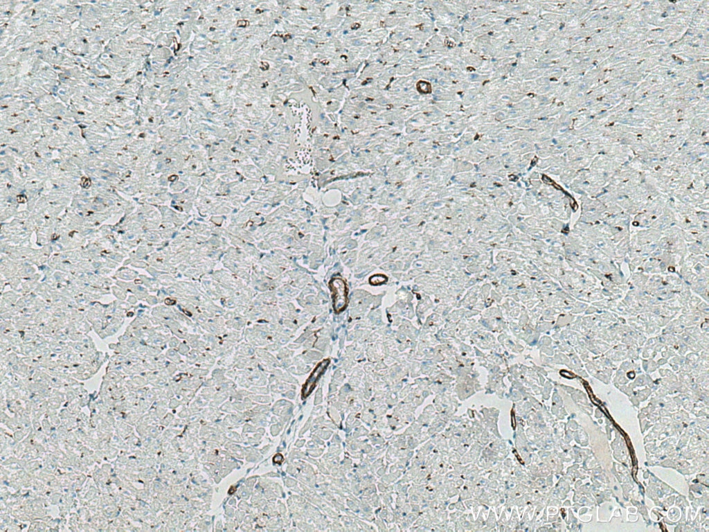 Immunohistochemistry (IHC) staining of human heart tissue using smooth muscle actin specific Recombinant antibody (80008-1-RR)