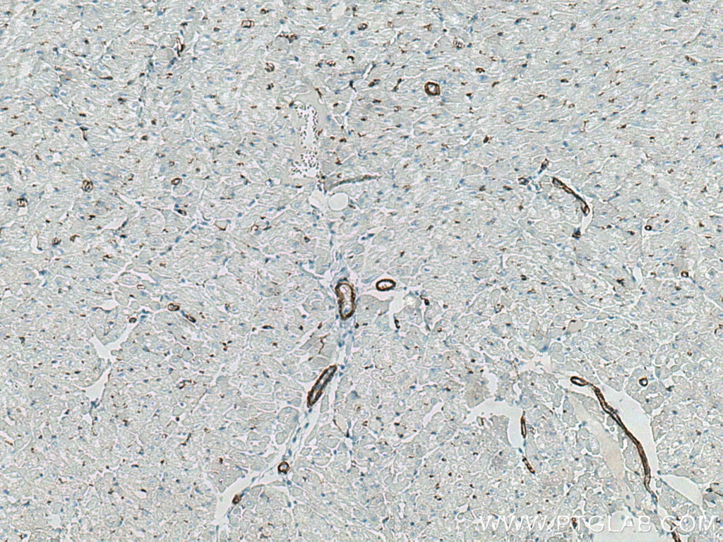 IHC staining of human heart using 80008-1-RR