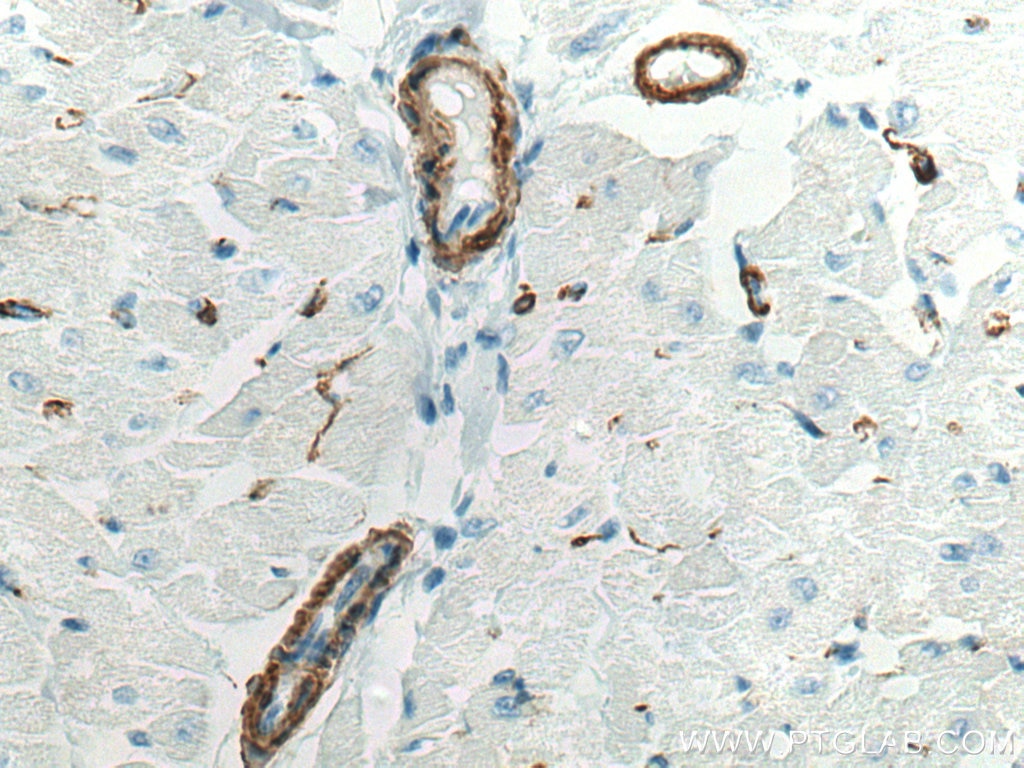 Immunohistochemistry (IHC) staining of human heart tissue using smooth muscle actin specific Recombinant antibody (80008-1-RR)