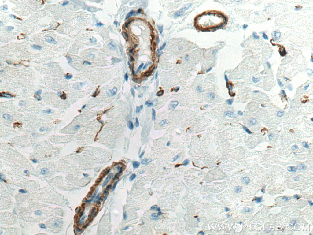 IHC staining of human heart using 80008-1-RR