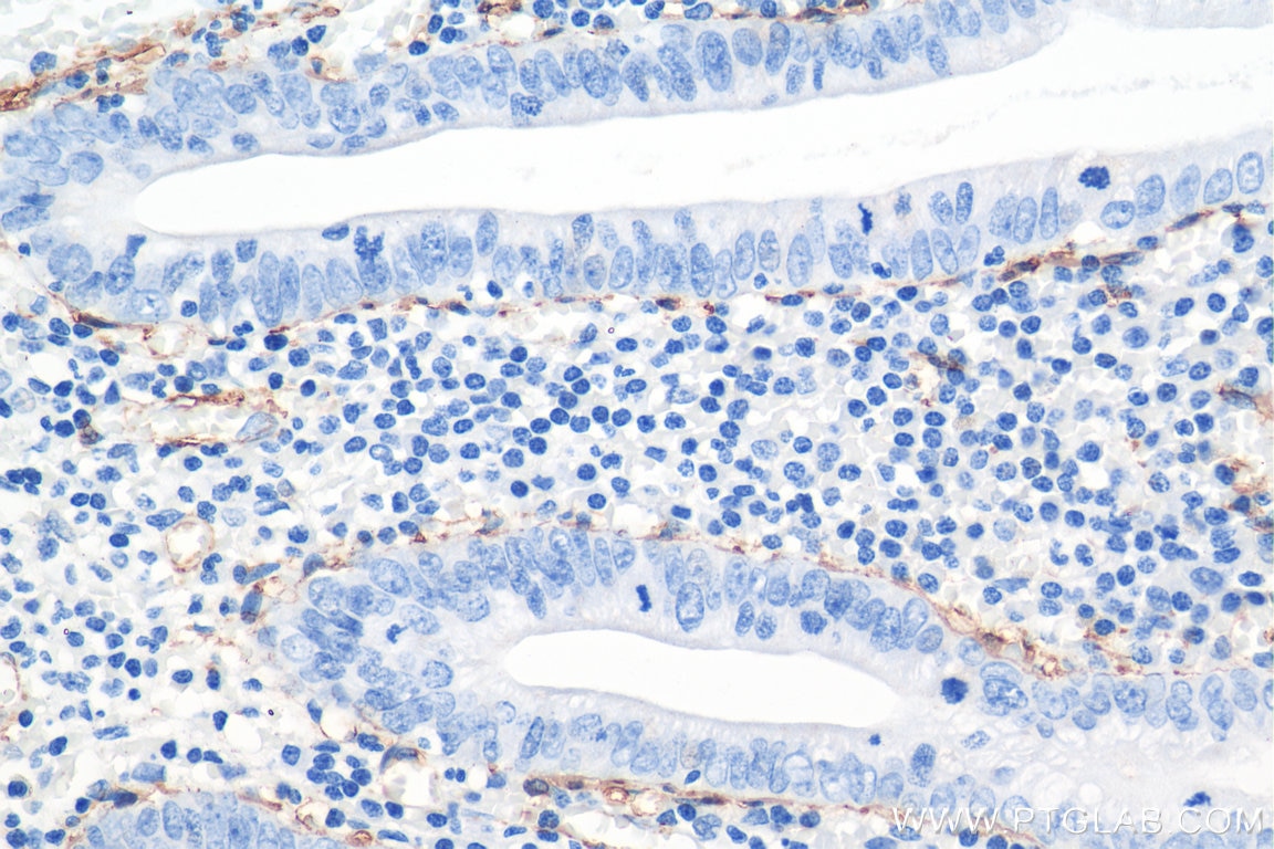 Immunohistochemistry (IHC) staining of human appendicitis tissue using smooth muscle actin specific Recombinant antibody (80008-1-RR)