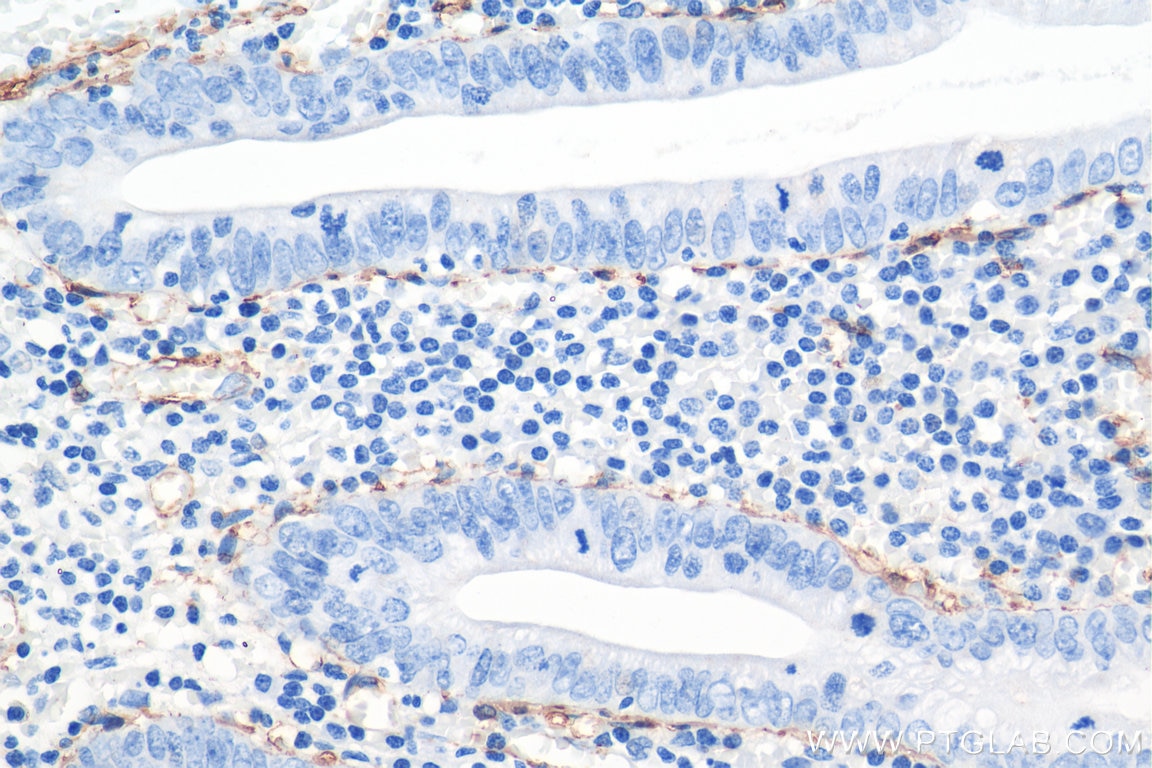 IHC staining of human appendicitis using 80008-1-RR