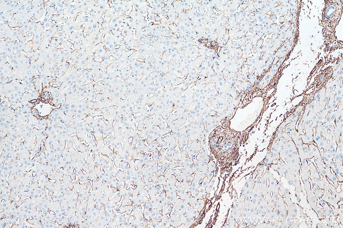 Immunohistochemistry (IHC) staining of human liver tissue using smooth muscle actin specific Recombinant antibody (80008-1-RR)