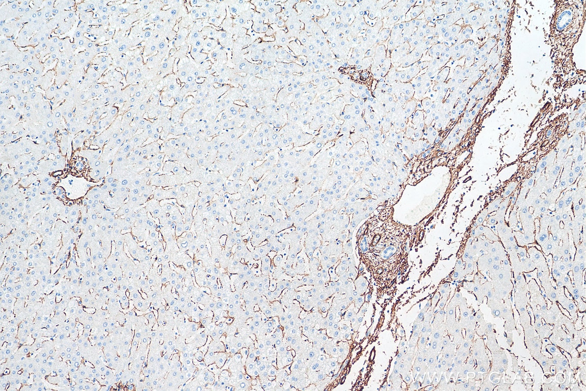 IHC staining of human liver using 80008-1-RR