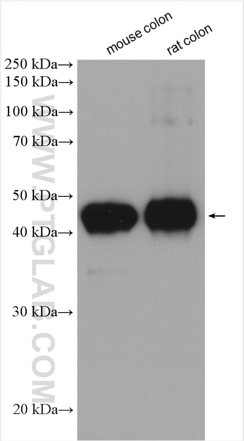 smooth muscle actin specific