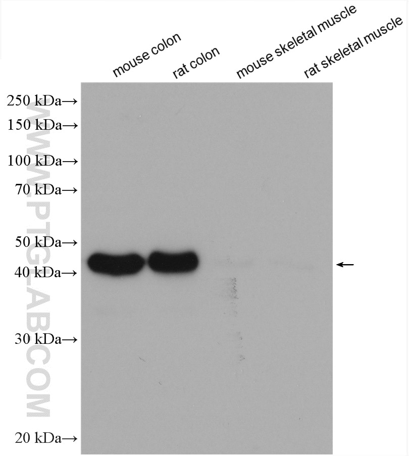 Western Blot (WB) analysis of various lysates using smooth muscle actin specific Recombinant antibody (80008-1-RR)