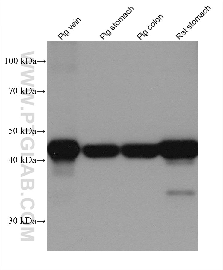 Western Blot (WB) analysis of various lysates using smooth muscle actin specific Recombinant antibody (80008-1-RR)