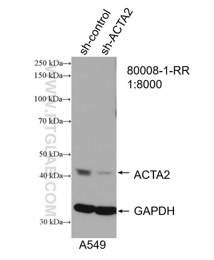 Western Blot (WB) analysis of A549 cells using smooth muscle actin specific Recombinant antibody (80008-1-RR)