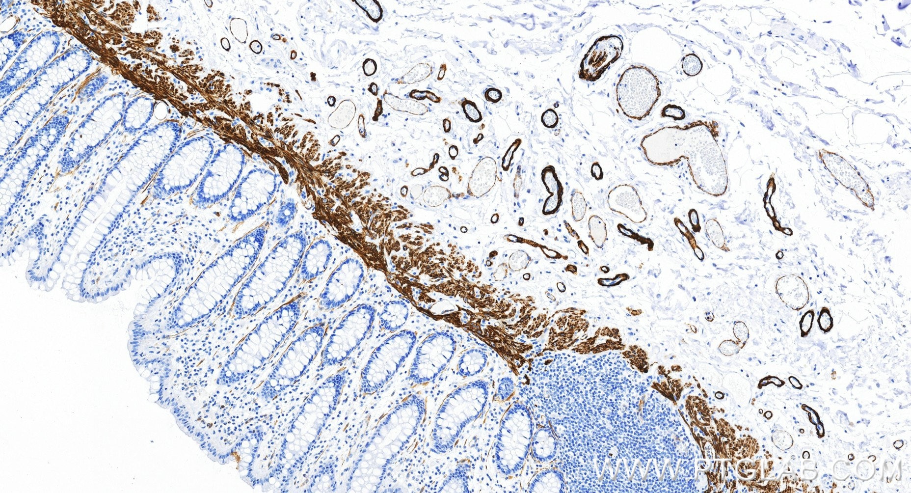 IHC staining of human colon using 80008-2-RR (same clone as 80008-2-PBS) Immunohistochemistry (IHC) staining of human colon tissue using Alpha smooth muscle actin specific Recombinant mon (80008-2-RR)