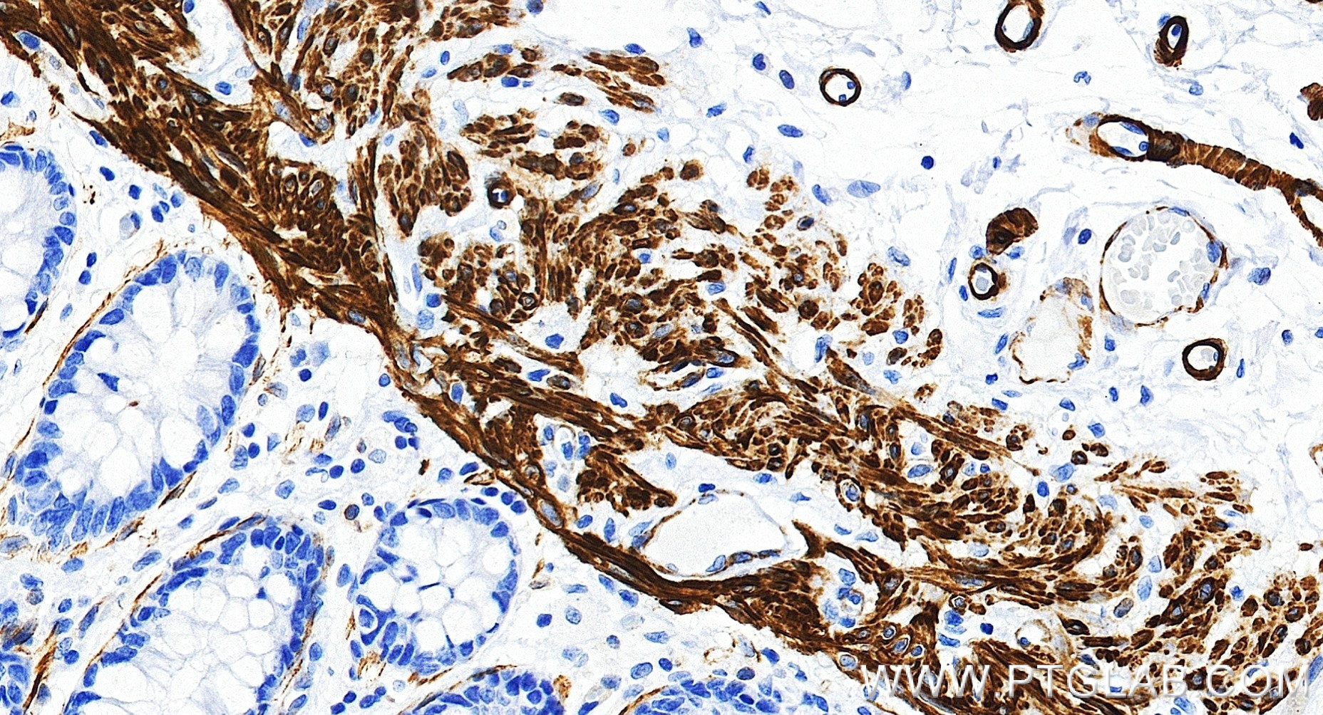 IHC staining of human colon using 80008-2-RR (same clone as 80008-2-PBS) Immunohistochemistry (IHC) staining of human colon tissue using Alpha smooth muscle actin specific Recombinant mon (80008-2-RR)
