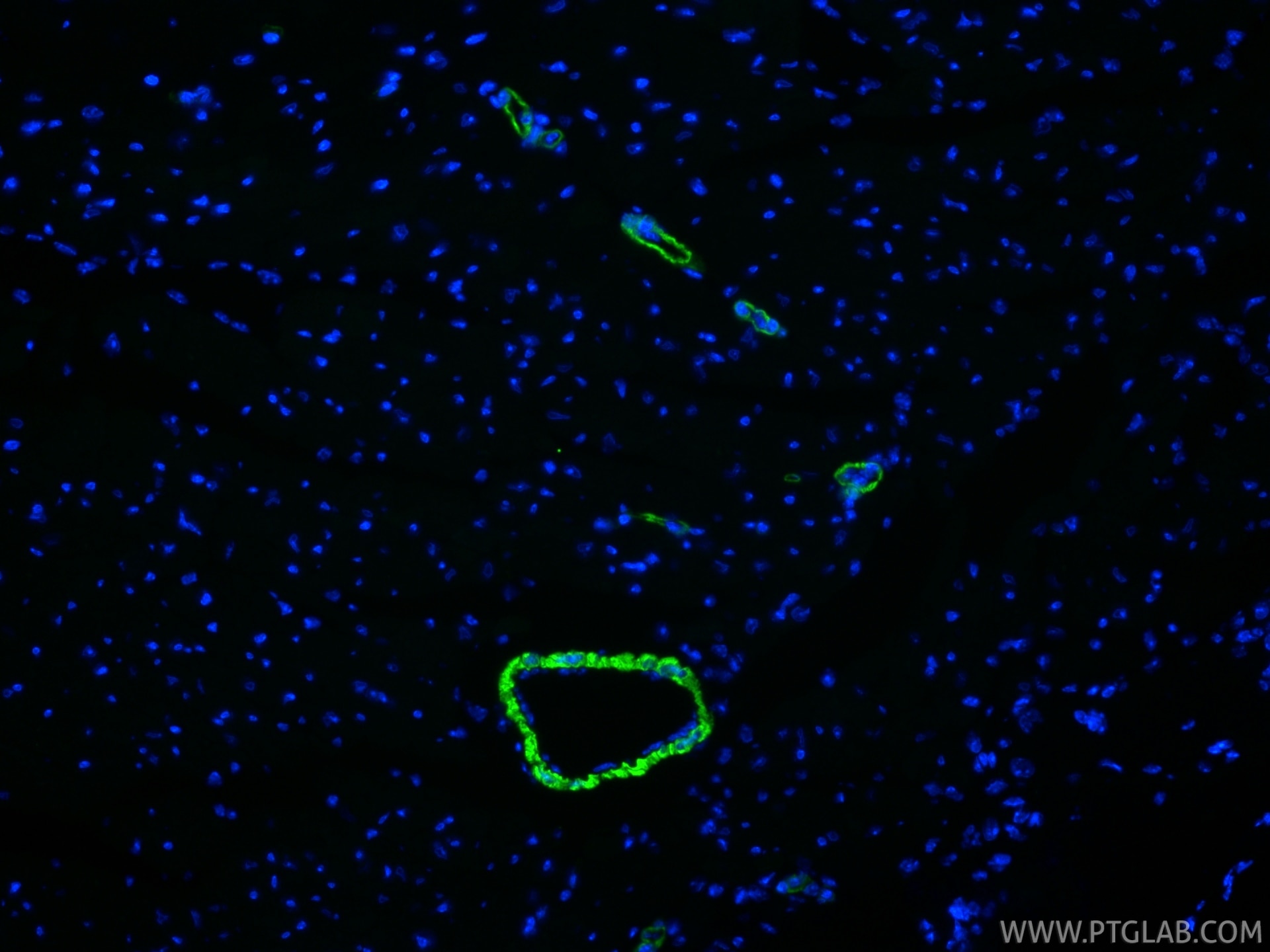 IF Staining of mouse heart using 80008-2-RR (same clone as 80008-2-PBS) Immunofluorescence (IF) / fluorescent staining of mouse heart tissue using Alpha smooth muscle actin specific Recombinant mon (80008-2-RR)