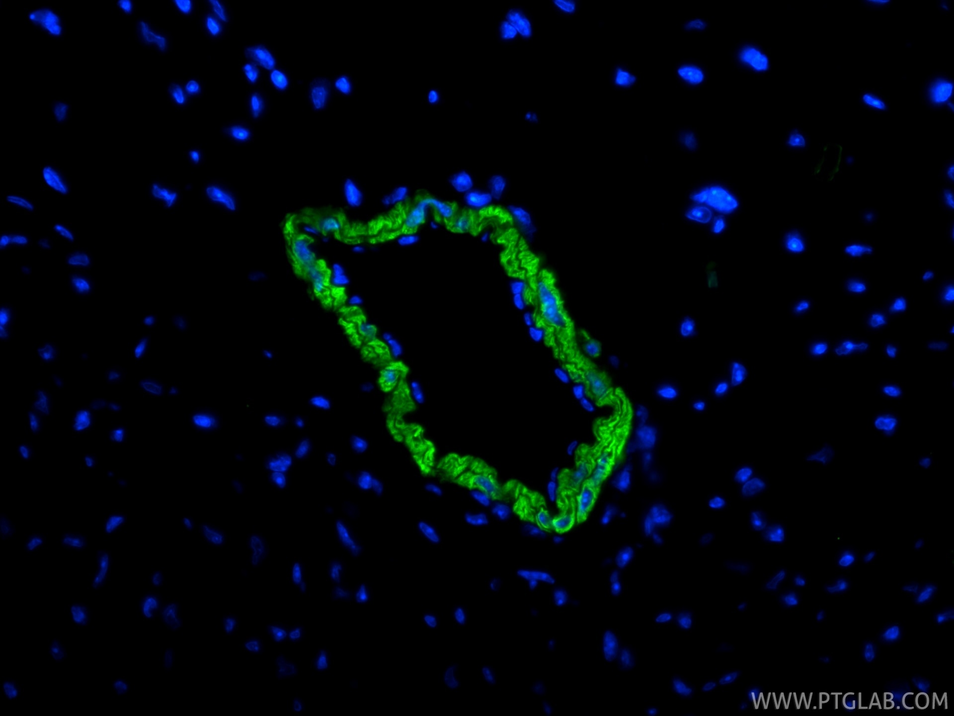 IF Staining of mouse heart using 80008-2-RR (same clone as 80008-2-PBS) Immunofluorescence (IF) / fluorescent staining of mouse heart tissue using Alpha smooth muscle actin specific Recombinant mon (80008-2-RR)