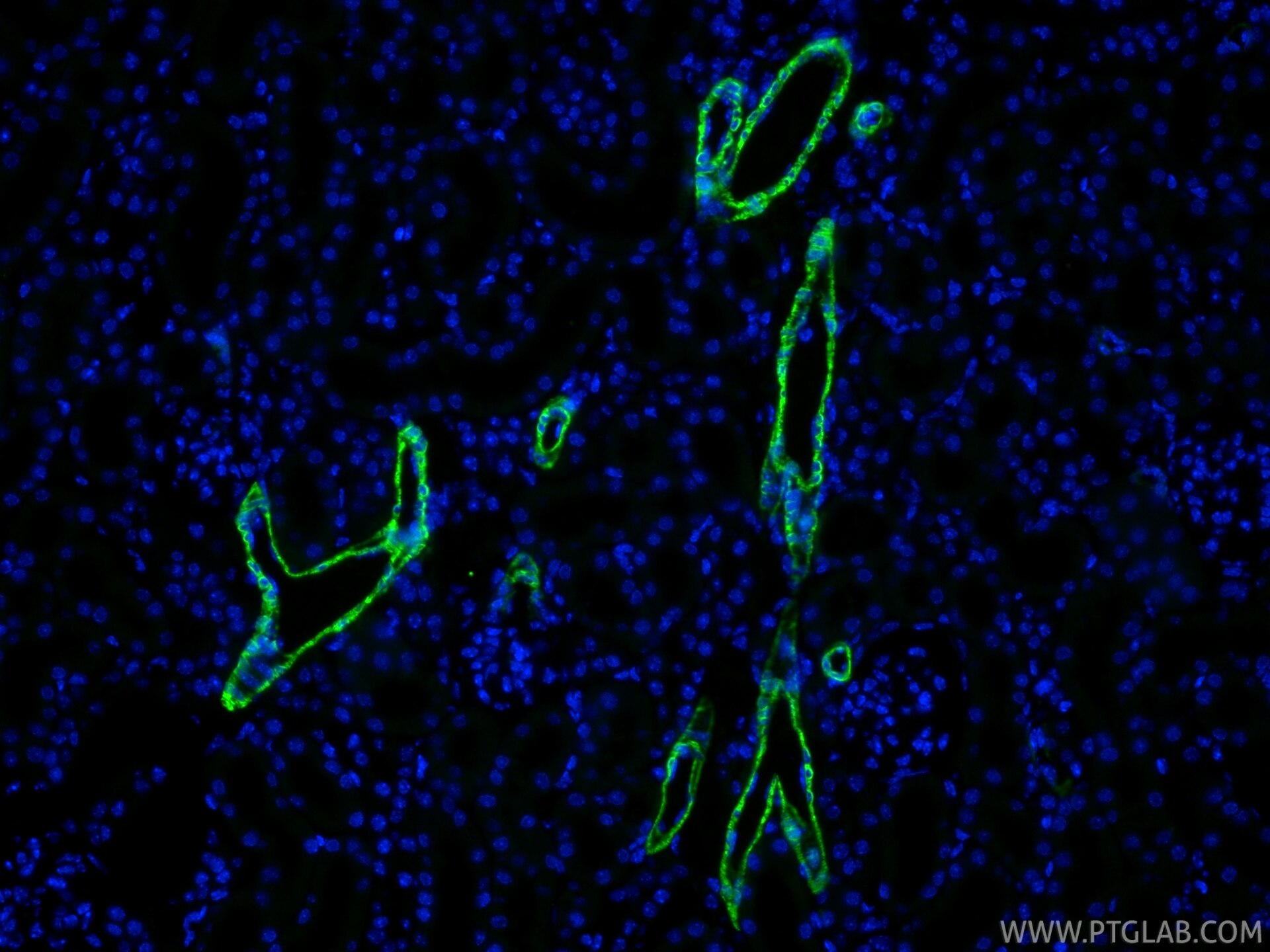 IF Staining of mouse kidney using 80008-2-RR (same clone as 80008-2-PBS) Immunofluorescence (IF) / fluorescent staining of mouse kidney tissue using Alpha smooth muscle actin specific Recombinant mon (80008-2-RR)
