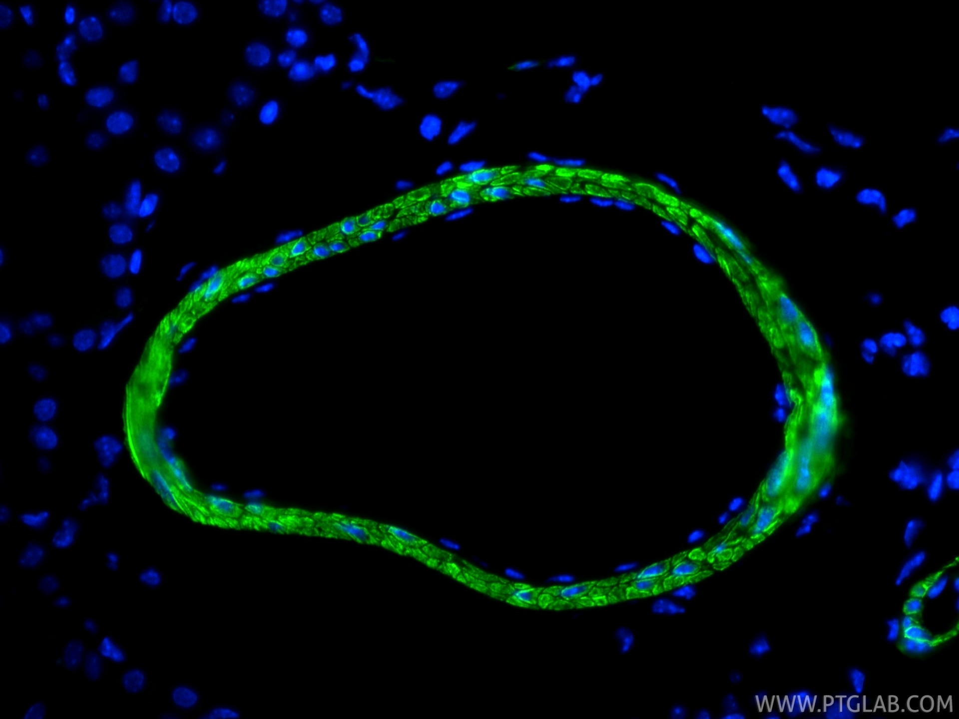IF Staining of mouse kidney using 80008-2-RR (same clone as 80008-2-PBS) Immunofluorescence (IF) / fluorescent staining of mouse kidney tissue using Alpha smooth muscle actin specific Recombinant mon (80008-2-RR)