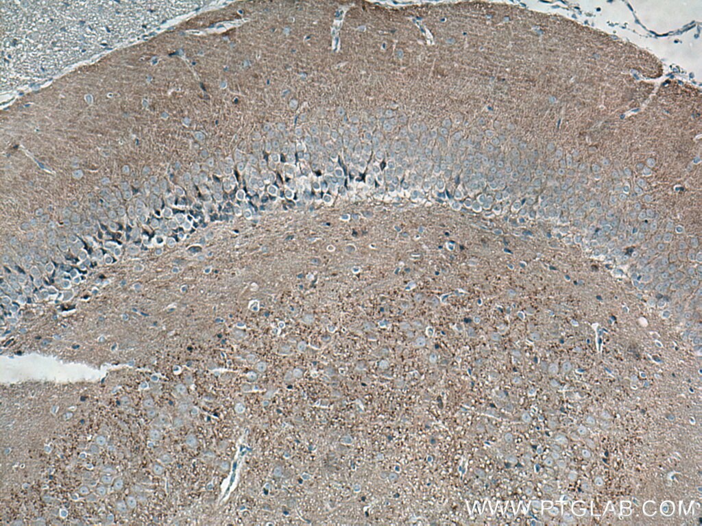 Immunohistochemistry (IHC) staining of rat brain tissue using Alpha Synuclein Monoclonal antibody (66412-1-Ig)