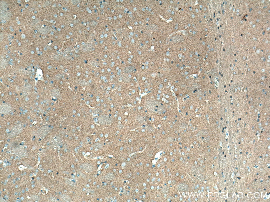 Immunohistochemistry (IHC) staining of mouse brain tissue using Alpha Synuclein Monoclonal antibody (66412-1-Ig)