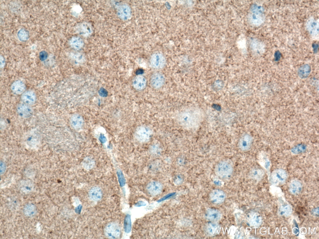 Immunohistochemistry (IHC) staining of mouse brain tissue using Alpha Synuclein Monoclonal antibody (66412-1-Ig)