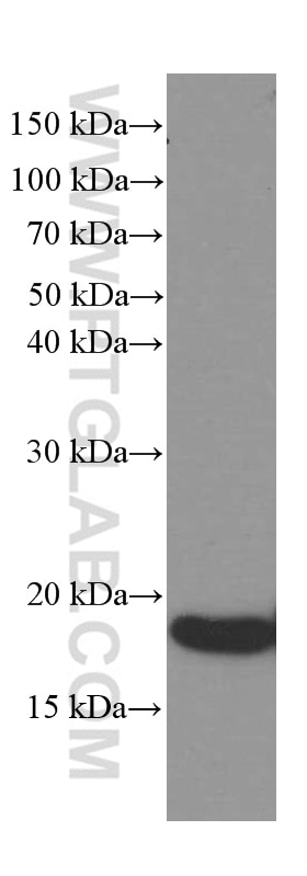 Western Blot (WB) analysis of rat brain tissue using Alpha Synuclein Monoclonal antibody (66412-1-Ig)